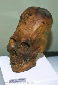 paracas_skull_parietal_bones