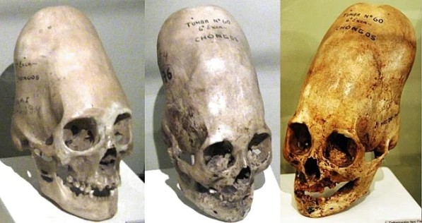 paracas_skulls