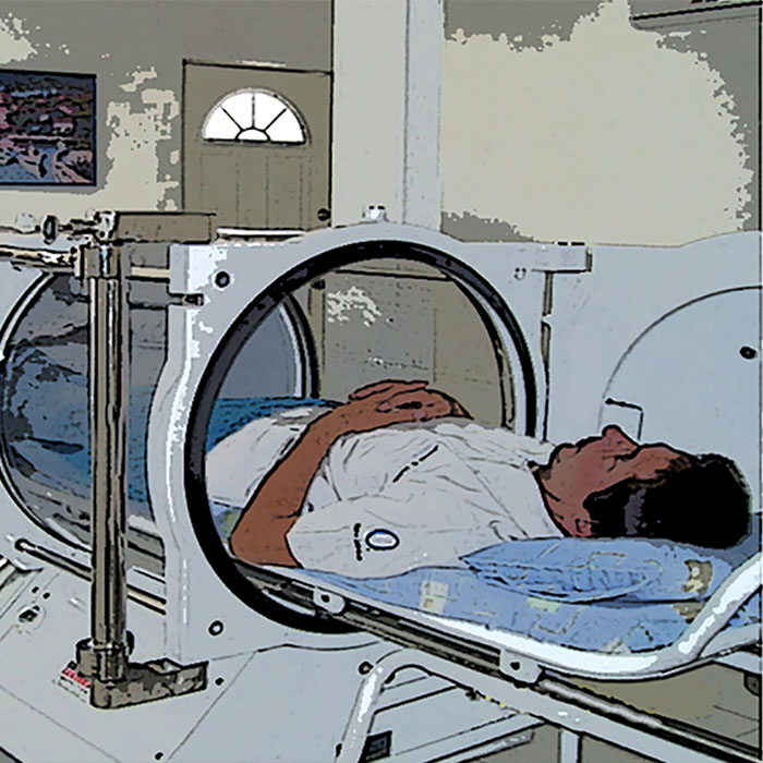 Medicina hiperbárica: entre la ciencia médica y las promesas exageradas